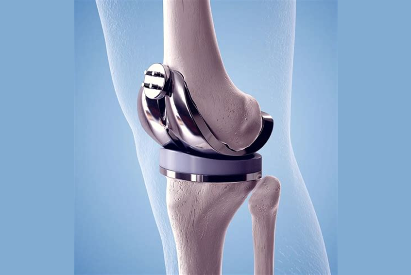 Best Knee Surgeon in Ahmedabad