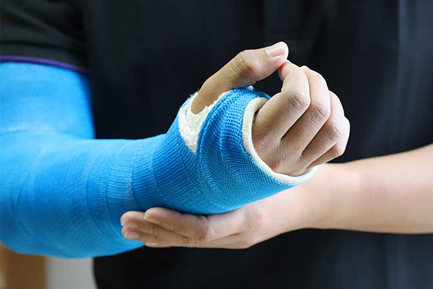 Fracture Treatment in Ahmedabad